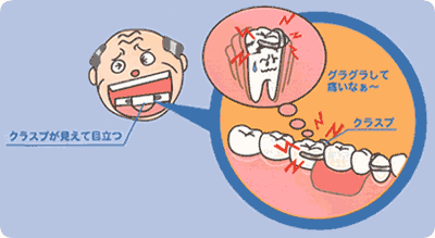 クラスプが見えて目立つ