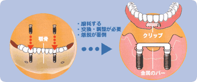 従来の治療法